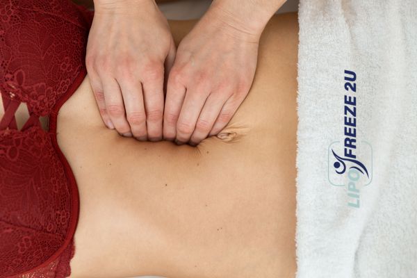 diastasis recti treatment Eastbourne