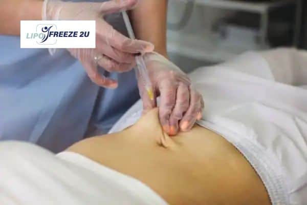 Fat Dissolving Injections Eastbourne & Weight loss medication