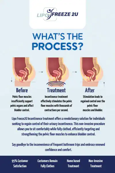 Diagram of how incontinence treatment Eastbourne works.
