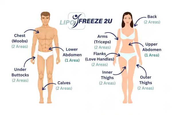 Areas you can have fat freezing treatment Eastbourne
