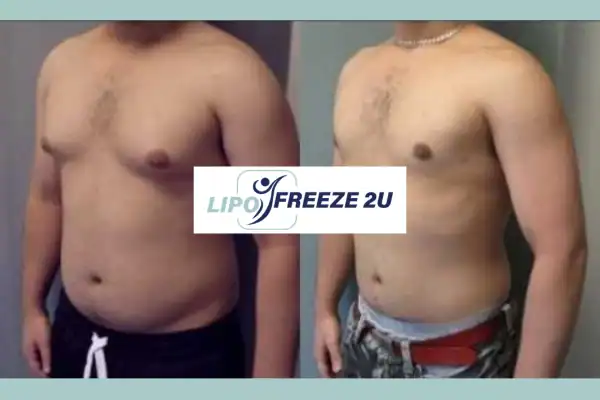 How Long Does It Take to See Results Eastbourne?