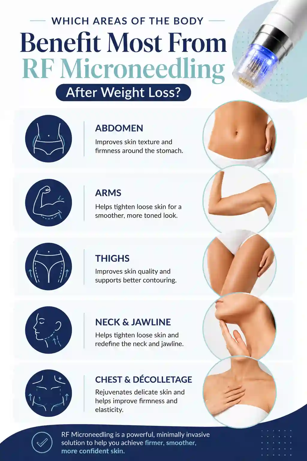 Which Areas of the Body Benefit Most From RF Microneedling After Weight Loss Eastbourne